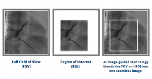 FOV-and-ROI-1-300x156