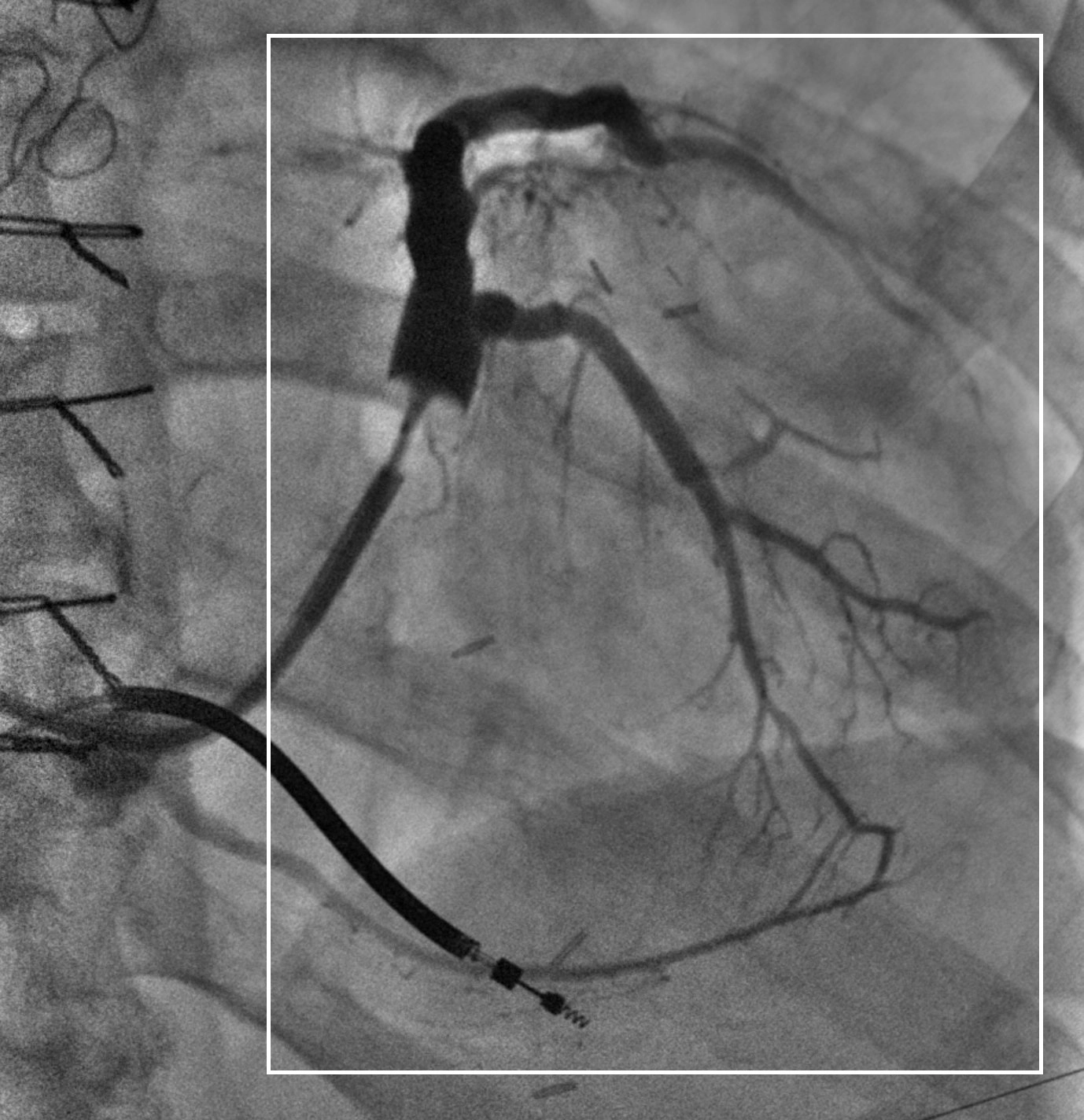Cardiac-ROI